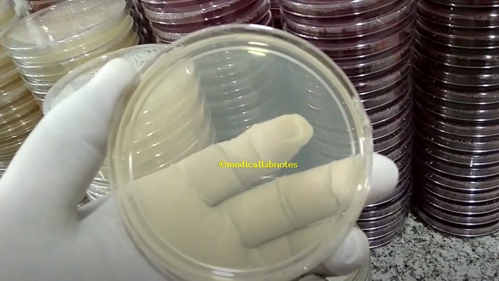 Mueller-Hinton agar (MHA): Introduction, Composition, Principle, Preparation Requirements, Testing Procedure, Colony Characteristics, Uses, Keynotes, and MHA Footages