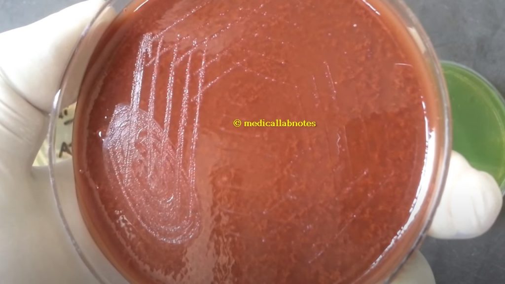 Neisseria gonorrhoeae colony morphology on chocolate agar