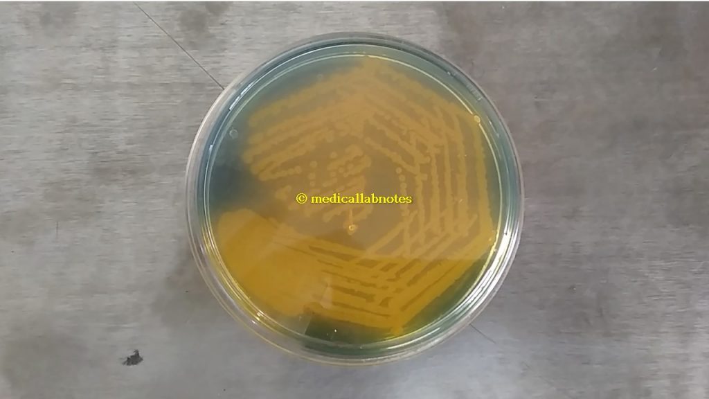 Pure well isolated Vibrio cholerae yellow colony on TCBS agar