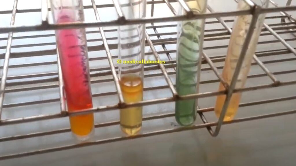 Salmonella Paratyphi Biochemical Tests in TSI, SIM, Citrate and Urea Agar Demonstration