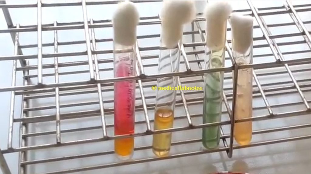 Salmonella Paratyphi biochemical reactions in TSI, SIM, urea agar, and citrate medium