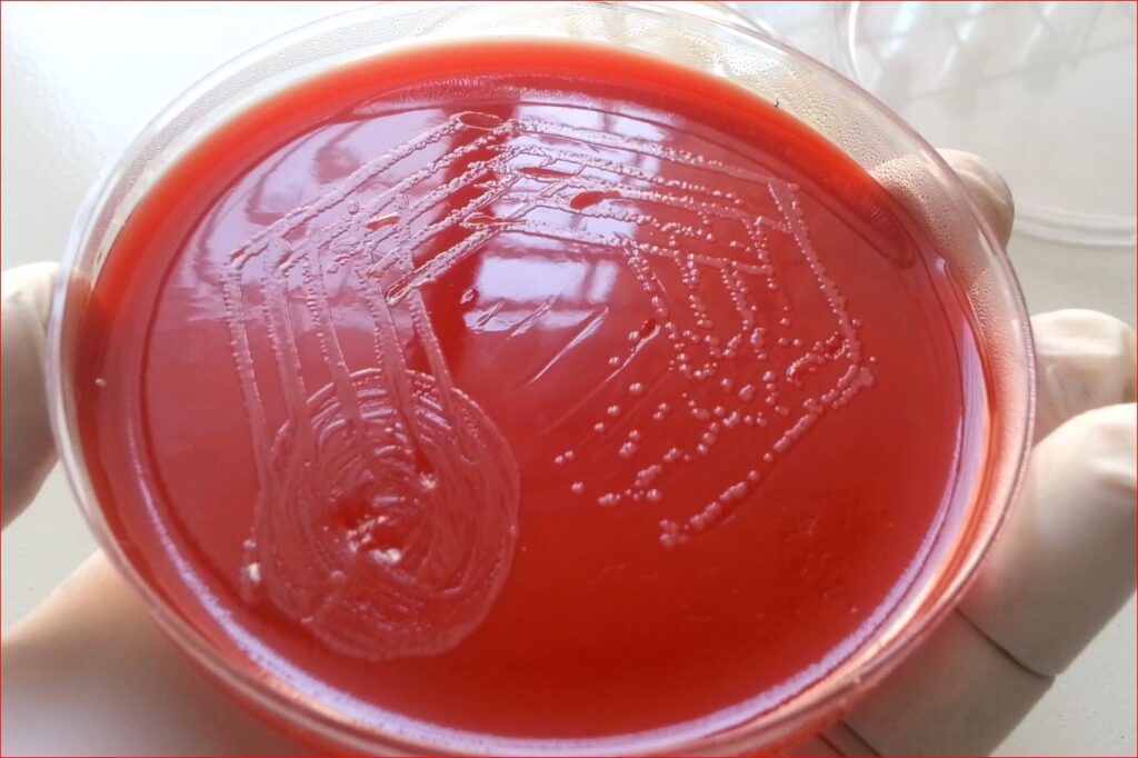 Salmonella Typhi Colony Characteristics on Blood Agar