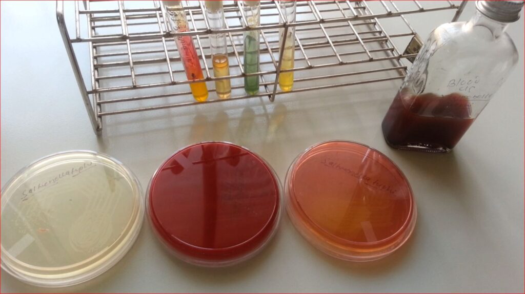 Salmonella Typhi Growth on Nutrient agar, Blood agar, MacConkey medium, BHI broth and biochemical assays in TSI, SIM, Citrate and urea agar