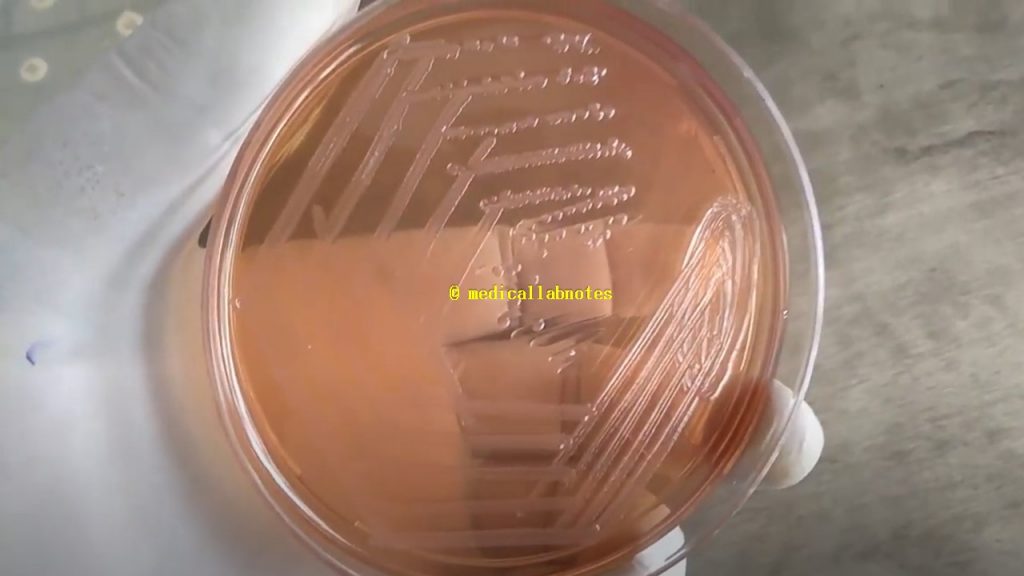 Salmonella growth on MacConkey agar