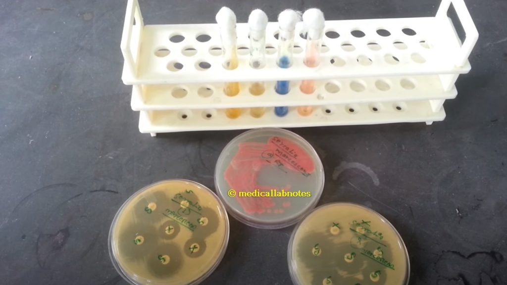 Serratia marcescens colony morphology on nutrient agar, biochemical reactions and antibiogram