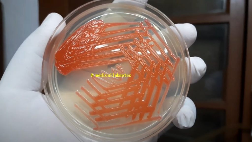 Serratia marcescens growth on Muller-Hinton agar with pigment expression Demonstration