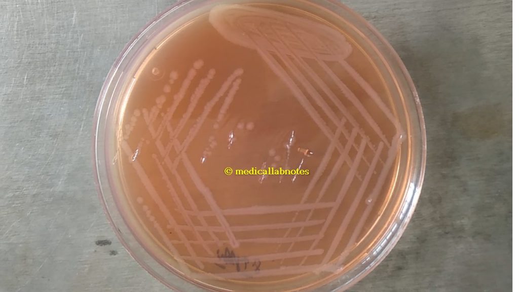 Shigella non-lactose fermenter colony on MacConkey agar