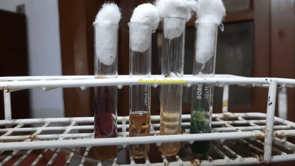 Shigella sonnei biochemical tests in TSI, SIM, Citrate and Urea agar Demonstration