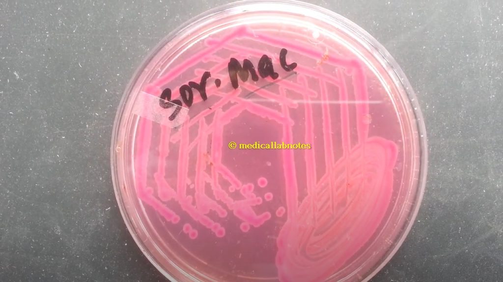 Sorbitol MacConkey Agar (SMAC) expressing sorbitol fermenting colony of E.coli and non-sorbitol fermenting colony of E.coli