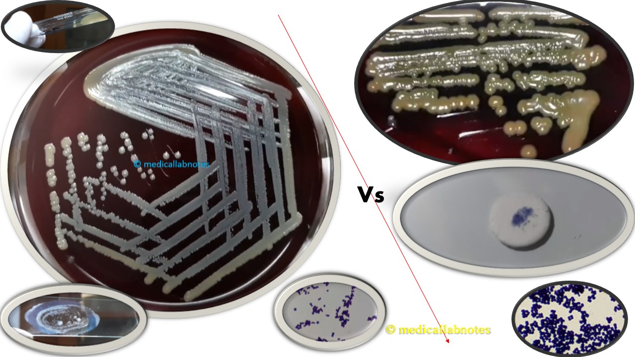Staphylococcus Vs Micrococcus: Introduction, Differentiating Features, Keynotes, and Related Footages