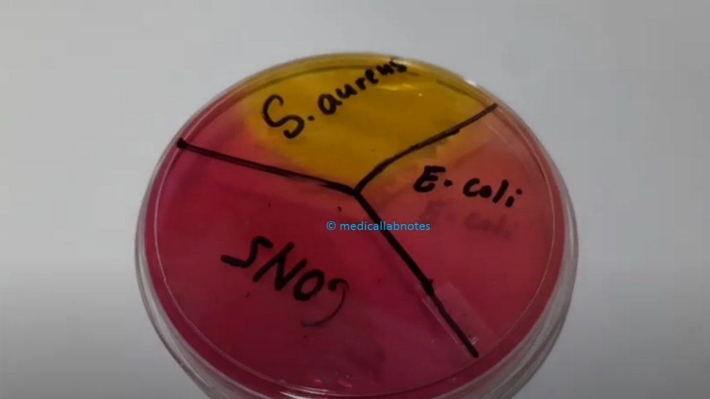 Staphylococcus aureus, CoNS and Escherichia coli growth on Mannitol Salt Agar ( MSA) Demonstration