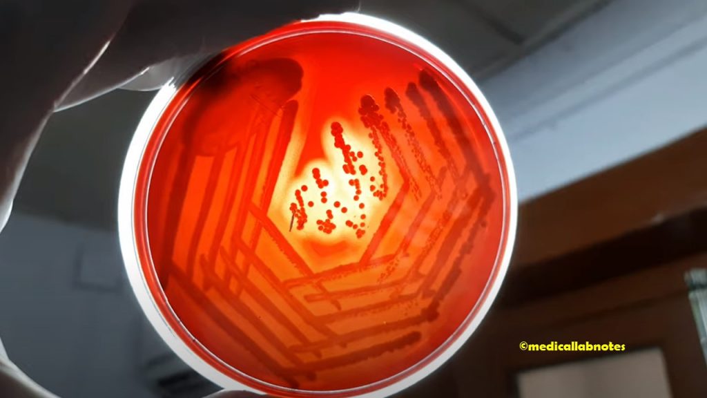 Staphylococcus aureus beta-hemolytic colony on blood agar