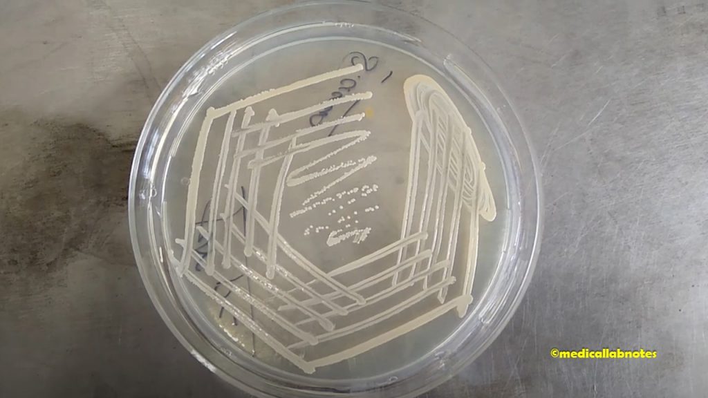 Staphylococcus aureus colony morphology on nutrient agar