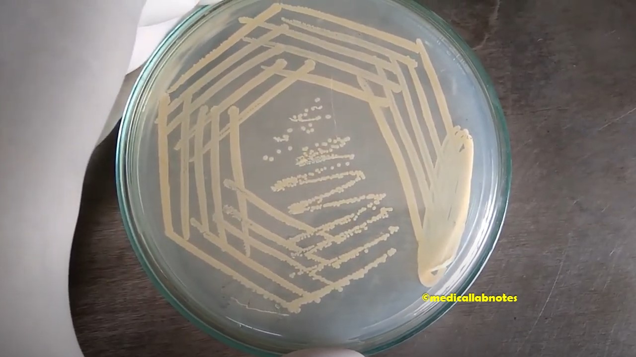 Staphylococcus aureus golden yellow colony on nutrient agar