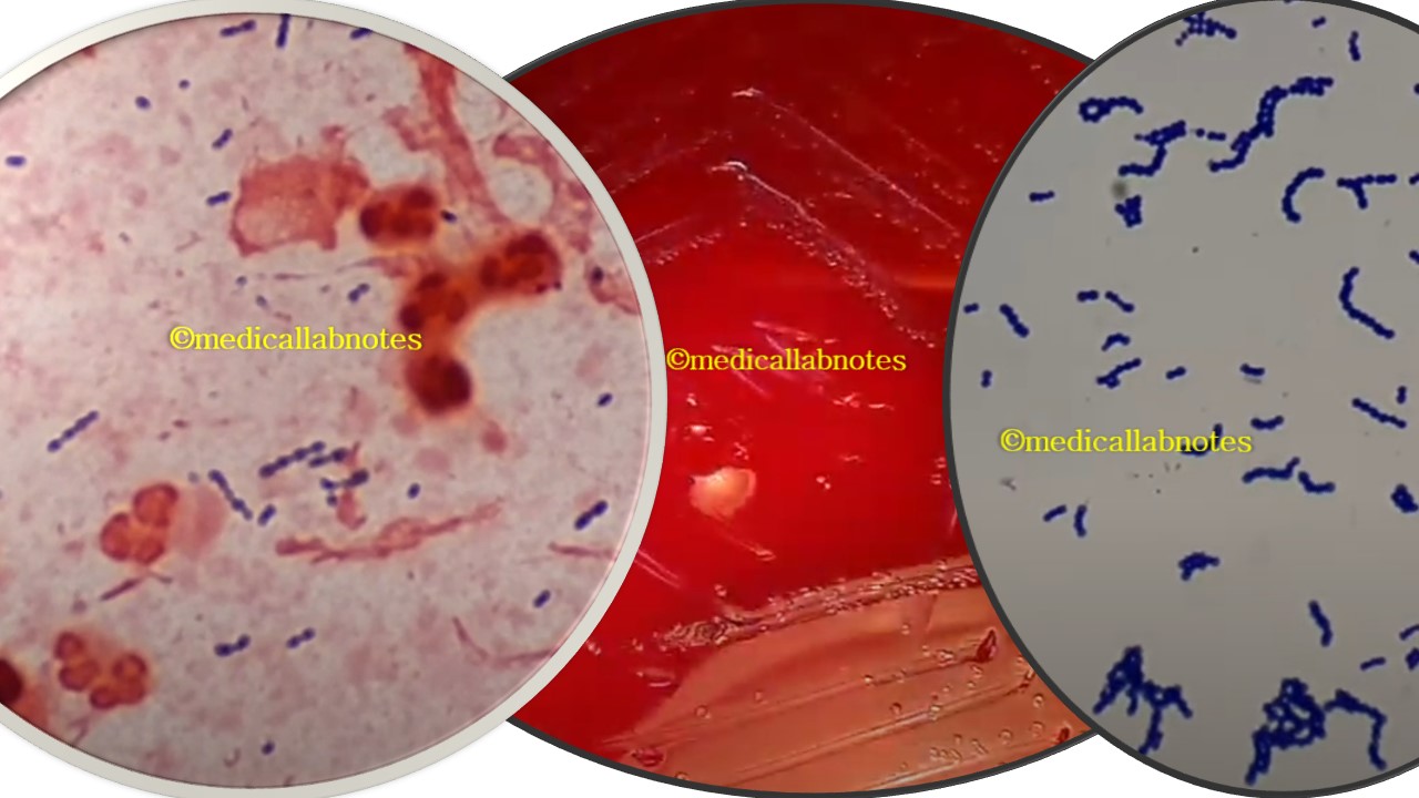 Streptococcus pneumoniae Versus Viridans streptococci- Introduction, Differentiating Features, Keynotes, Pneumococcus, and Viridans streptococci Footages