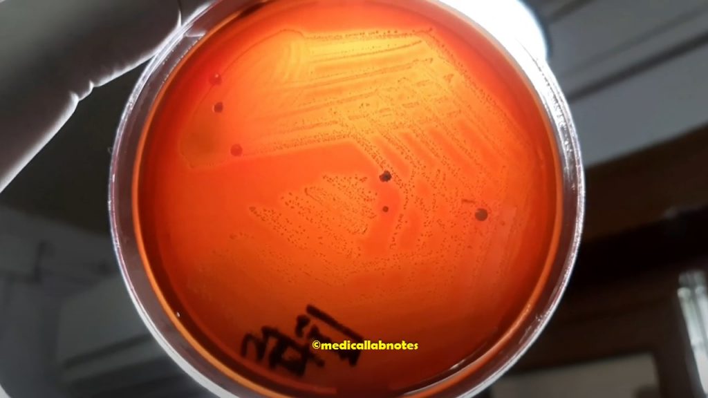 Streptococcus pyogenes beta-hemolytic colony morphology on 5% sheep blood agar