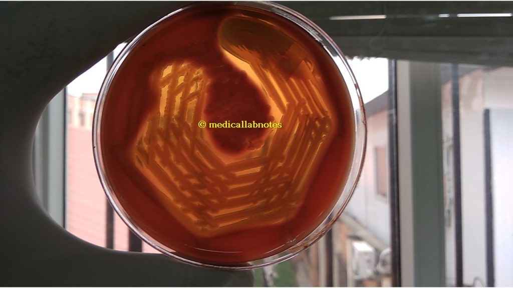 Vibrio cholerae causing haemodigestion on blood agar 