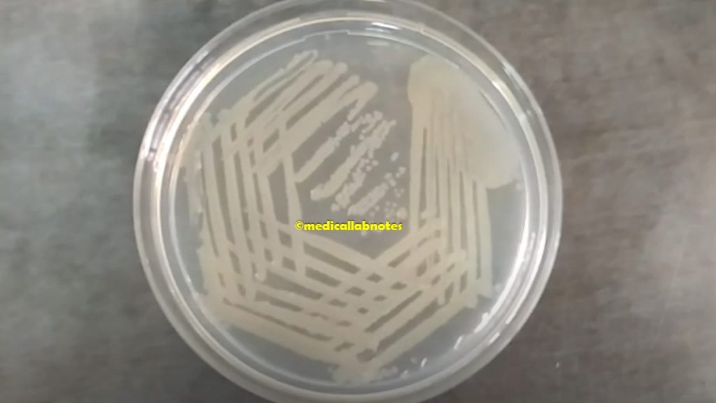 Vibrio cholerae colony characteristics on nutrient agar