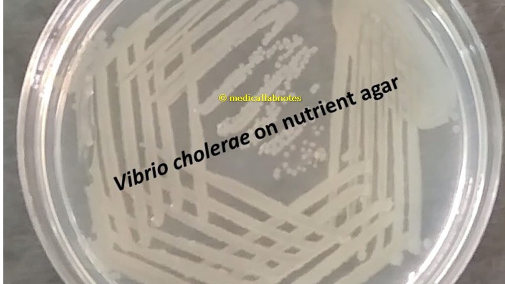 Vibrio cholerae colony morphology on nutrient agar