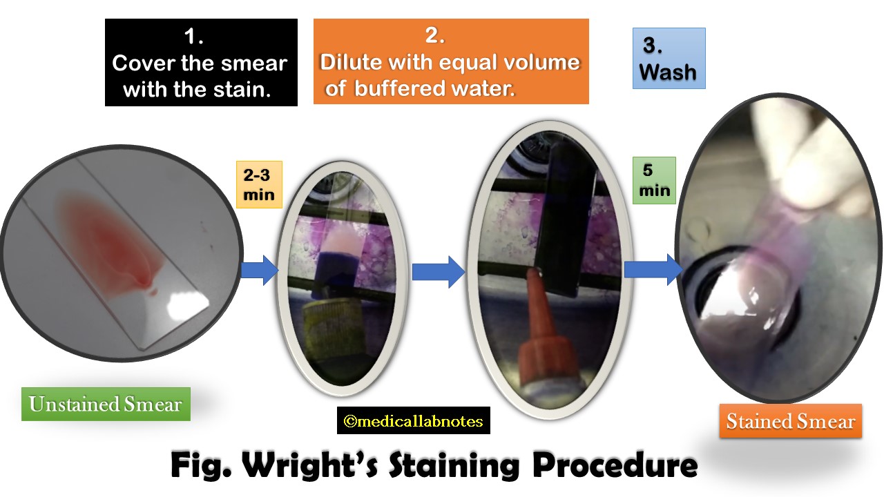 Wright Stain-Introduction, Principle, Preparation, Procedure, Result-Interpretation, Keynotes, Wright’s Stained Footages