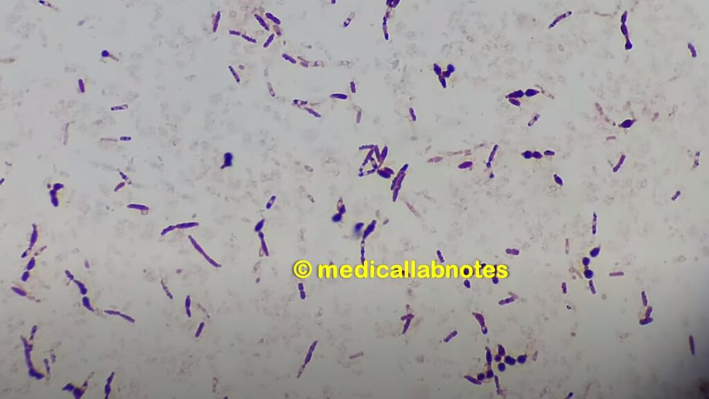 Bacillus species in Gram staining of culture