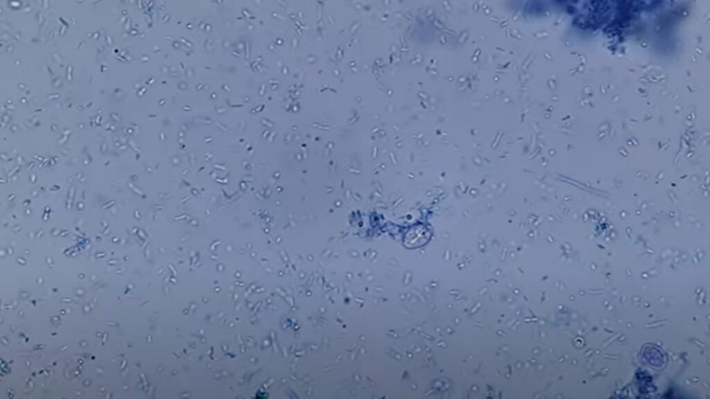 Cyst of Giardia in Methyle blue staining