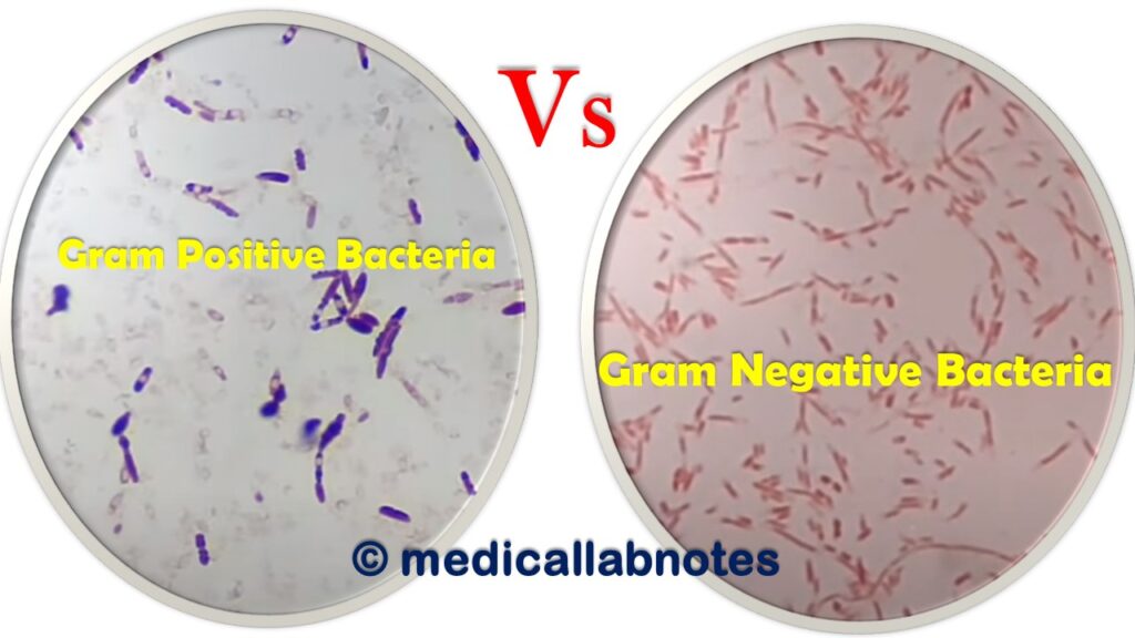 Differences between Gram Positive and Gram Negative Bacteria: Introduction, and Related Footages