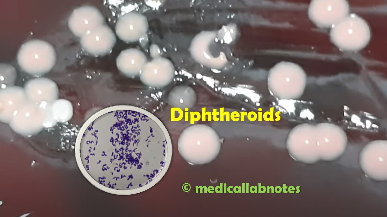 Differences between Diphtheria bacillus and Diphtheroids