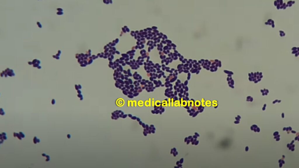 Enterococcus faecalis in Gram staining of culture 