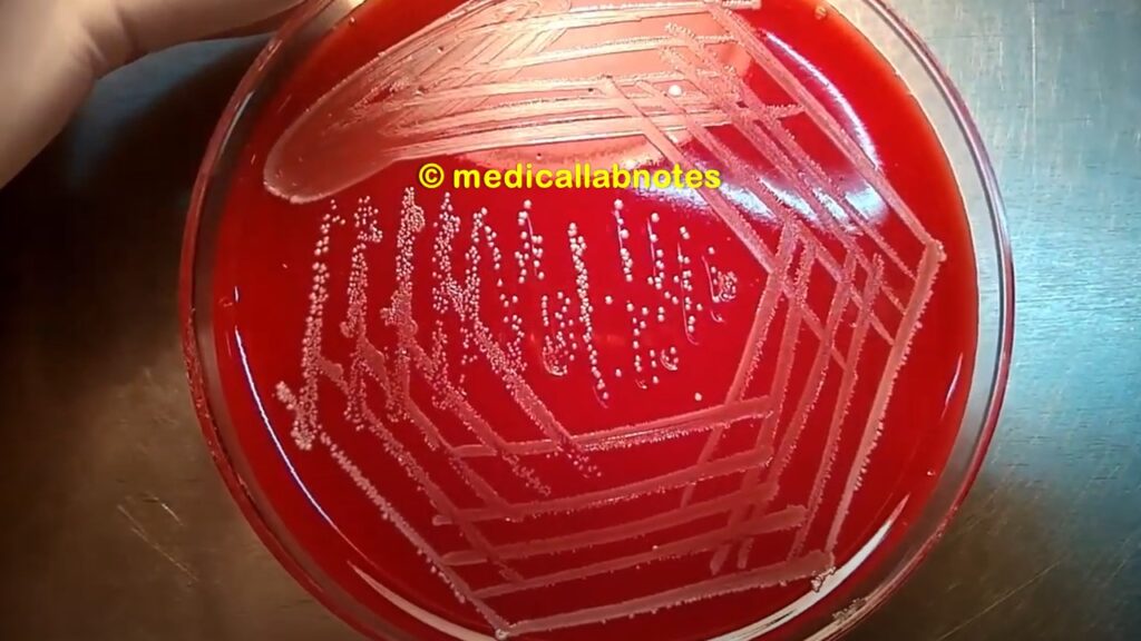 Enterococcus growth on blood agar