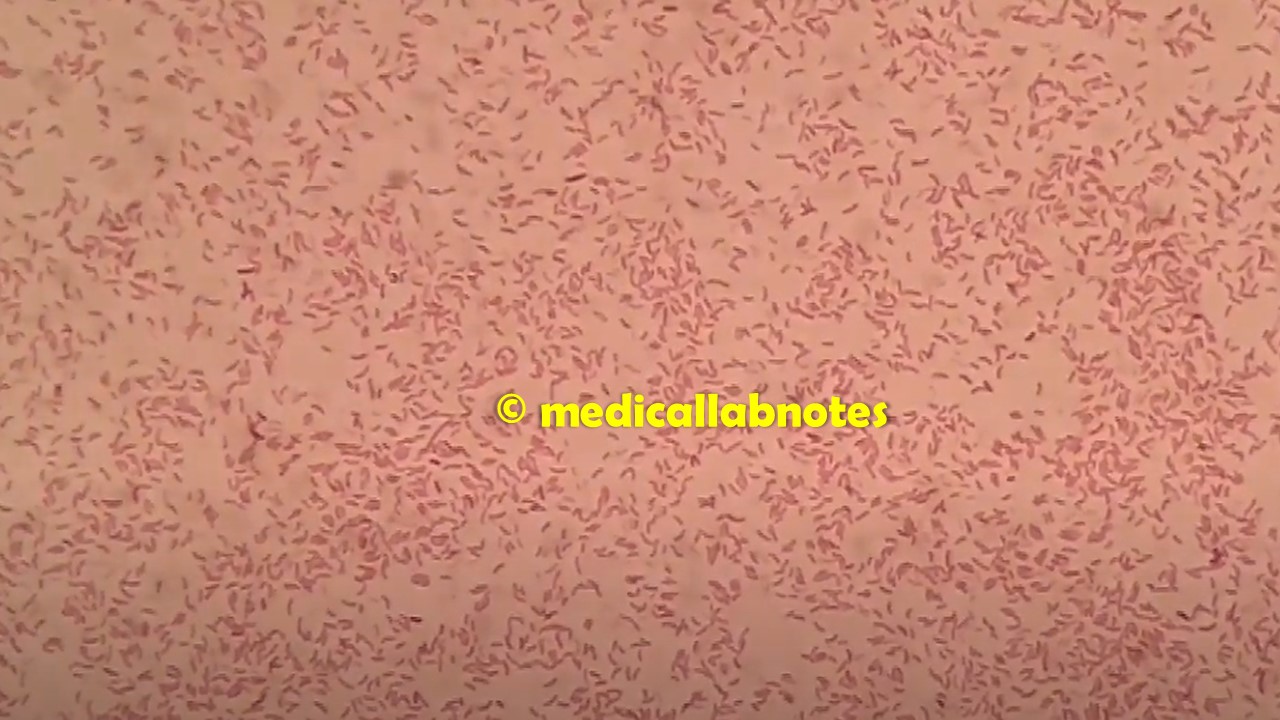 Some Typical Arrangements of Bacteria: List, Keynotes, and, Few