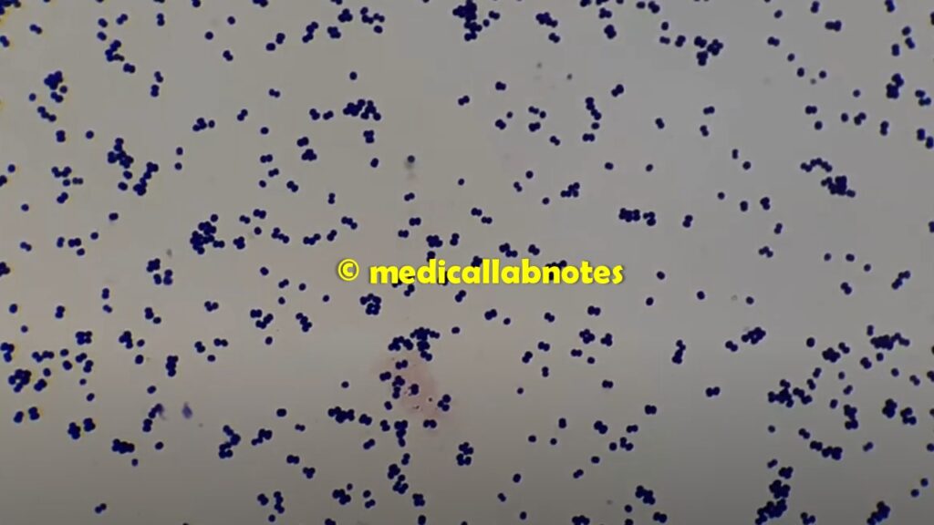 Gram-positive cocci in four cells or tetrads of Micrococcus in Gram staining of culture