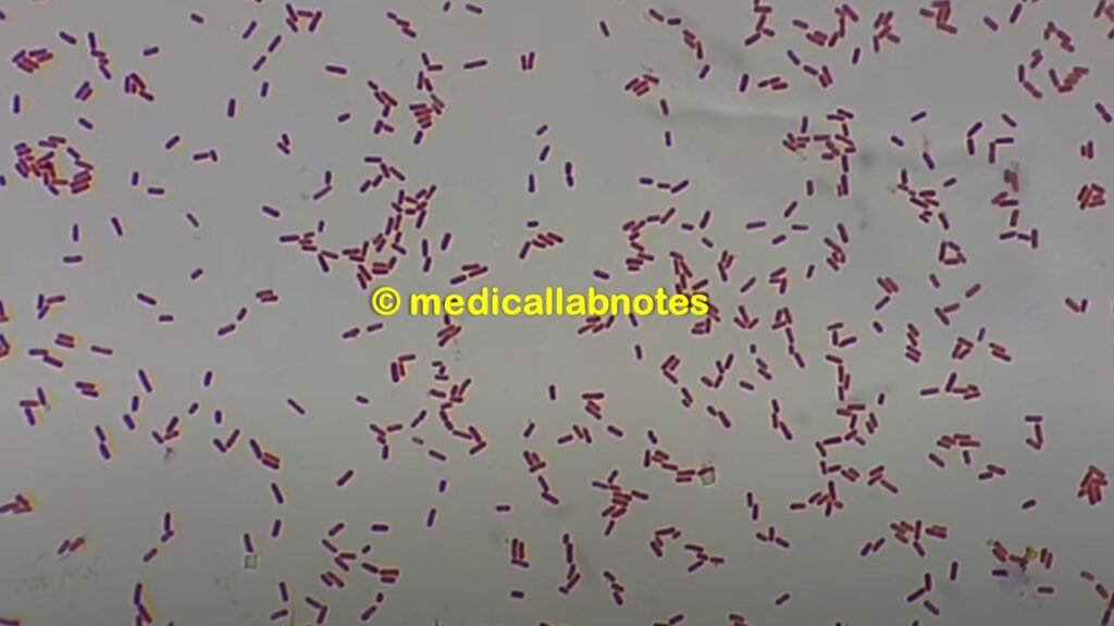 Klebsiella pneumoniae in Gram staining 
