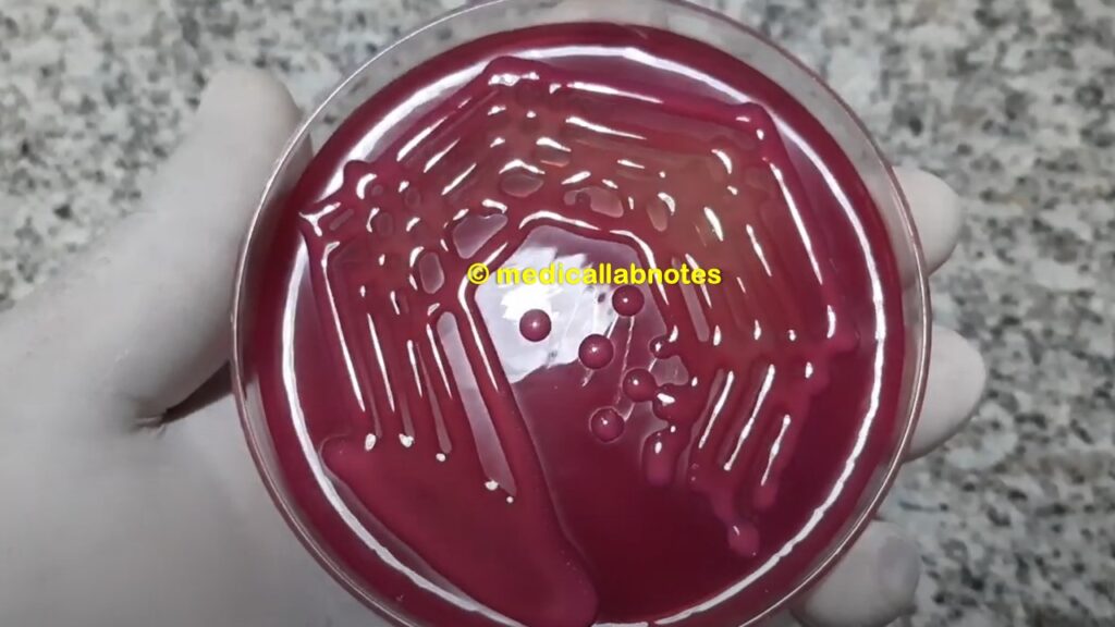 Klebsiella pneumoniae mucoid lactose fermenter colony on MacConkey agar