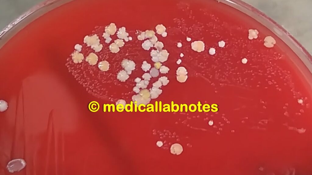 Neisseria gonorrhoeae on blood agar of urethral discharge culture
