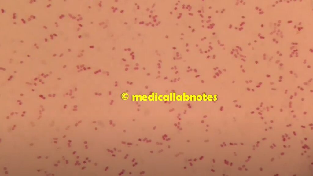 Neisseria meningitidis or Meningococcus in Gram staining of culture