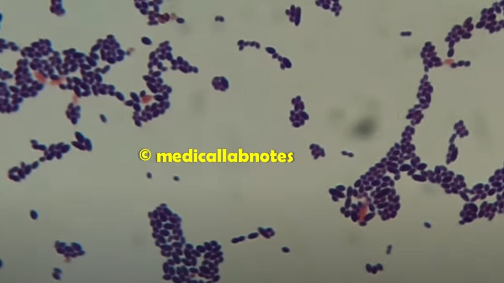 Pairs or in short chain, spectacle eyed shape Enterococcus faecalis in Gram staining of culture