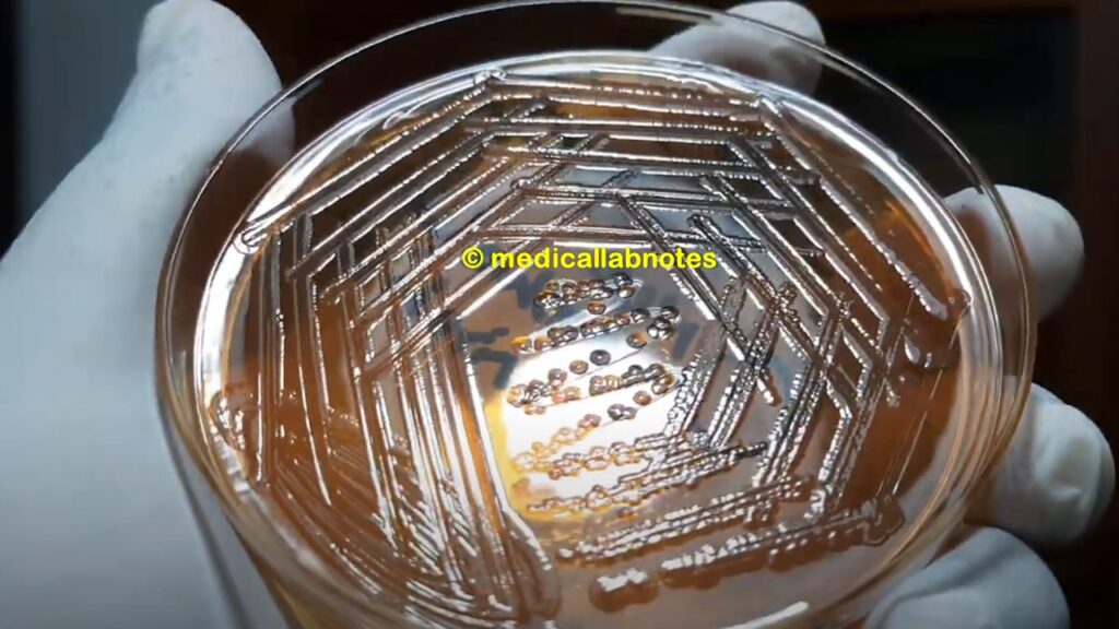 Proteus non-lactose fermenter colony on MacConkey medium