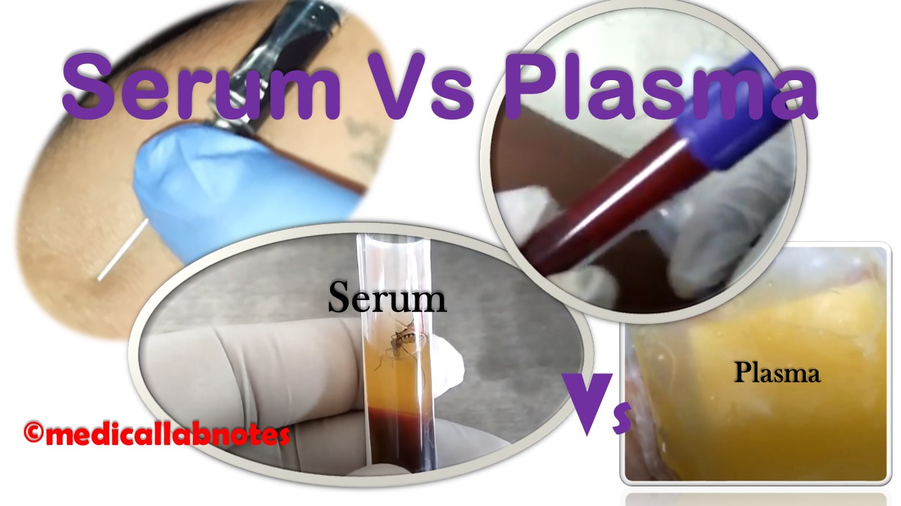 Serum and Plasma: Introduction, Differences, Keynotes, and Related Footages