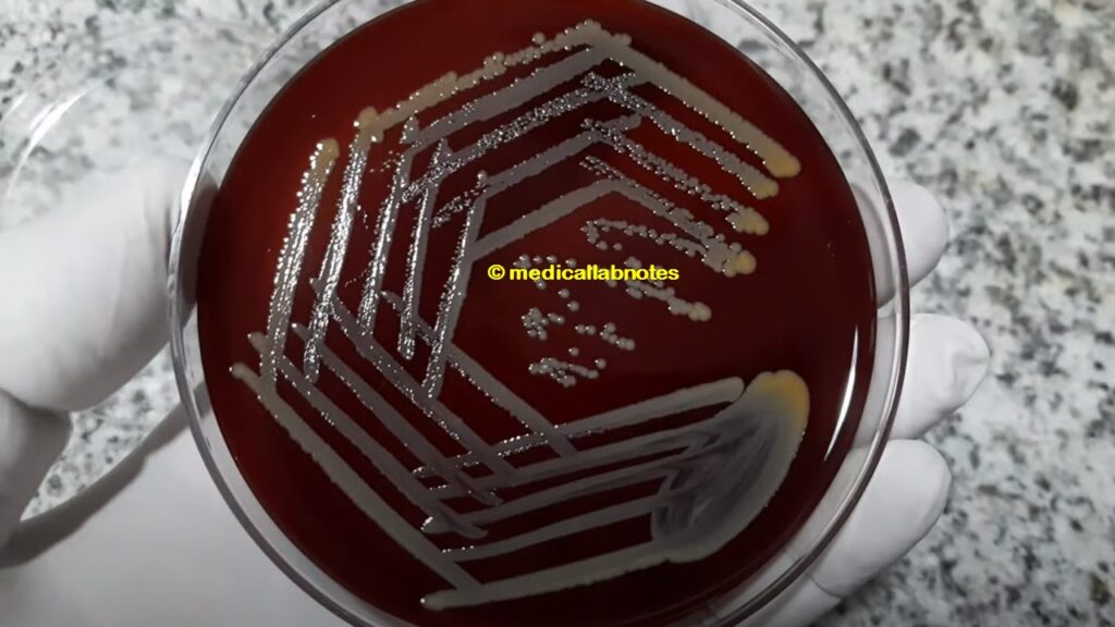 Staphylococcus aureus colony morphology on blood agar