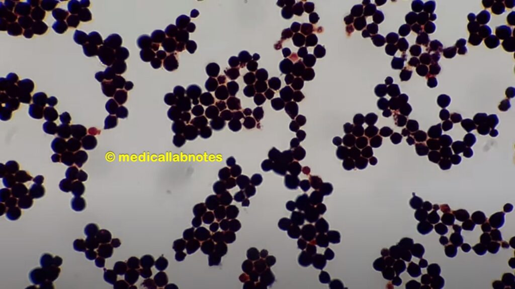 Yeast cells of Cryptococcus neoformans in Gram staining of culture at a high magnification