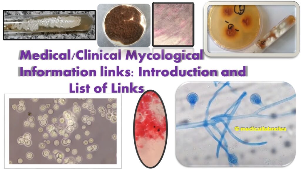 Medical or Clinical Mycological Informations links- Introduction and List of Links