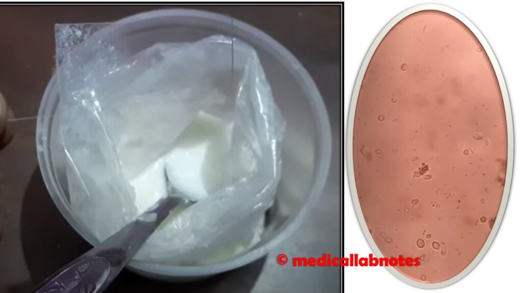 Probiotics: Introduction, List of Probiotics, Dose,Health Benefits, and Probiotics Products in Market