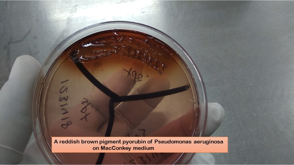 A reddish-brown pigment pyorubin of Pseudomonas aeruginosa of clinical specimen  on MacConkey medium demonstration