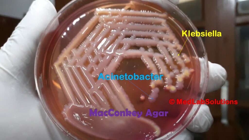Acinetobacter and Klebsiella colony characteristics on Macconkey agar Demonstration
