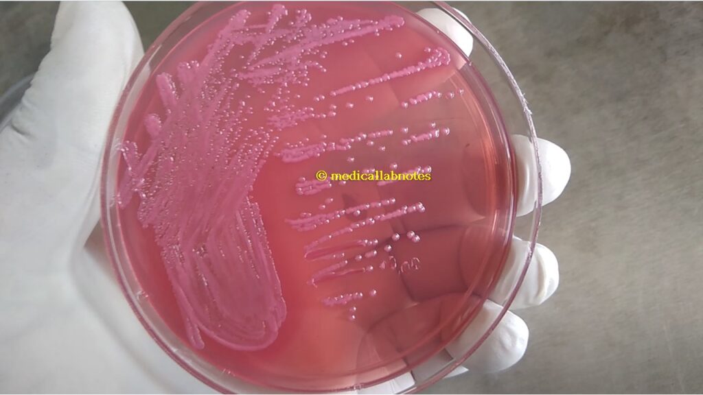 E. coli Colony Characteristics on MacConkey medium