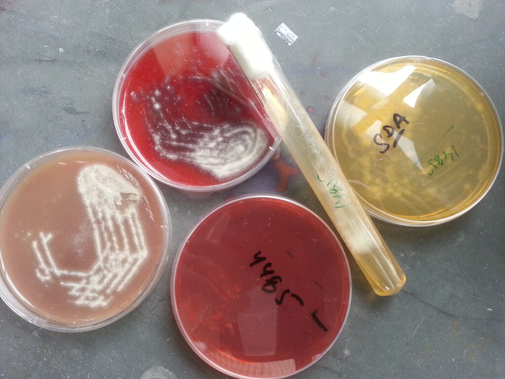 Fungal growth on  blood agar, MacConkey medium, chocolate agar and SDA demonstration