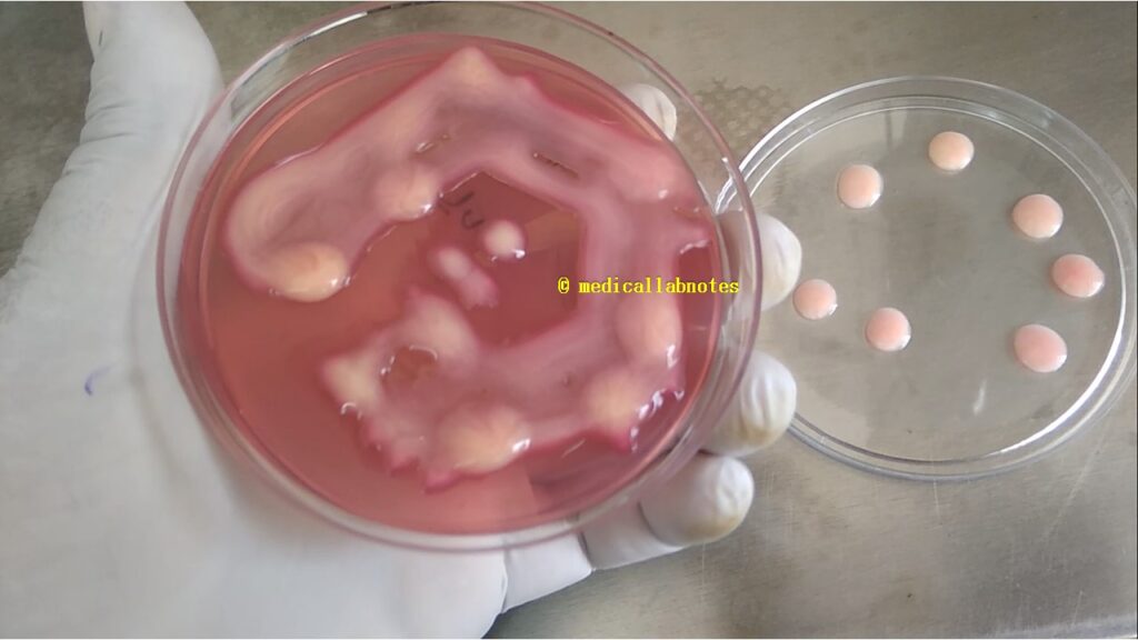 Heavily mucoid lactose fermenter (MLF) colony of Klebsiella pneumoniae on MacConkey agar