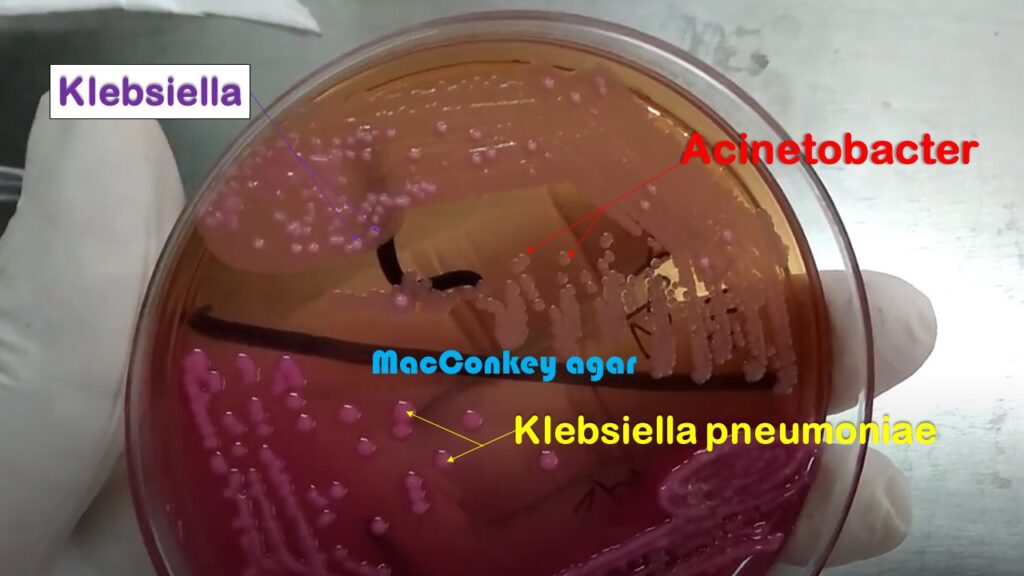Klebsiella and Acinetobacter growth on MacConkey agar of clinical specimen  ICU admitted patient sputum