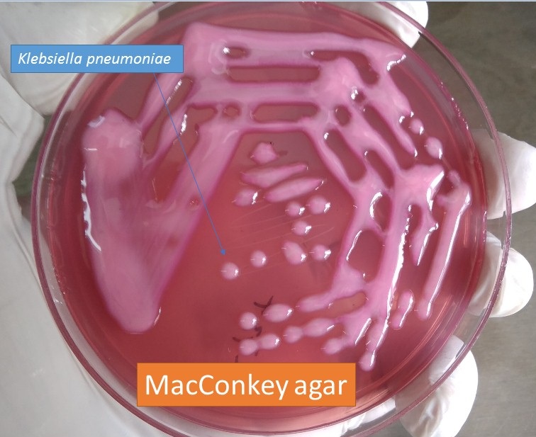 Klebsiella pneumoniae mucoid lactose fermenter colony on MacConkey medium Demonstration